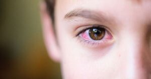 Hướng dẫn chăm sóc và điều trị an toàn