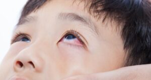 Phân loại các nguyên nhân gây bệnh