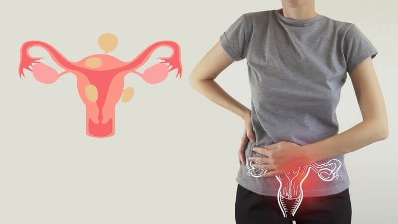 Đau bụng bên phải là bệnh gì? Nhận biết theo vị trí để tránh bỏ sót dấu hiệu nguy hiểm 3 Phụ nữ đau bụng dưới bên phải cần đánh giá thêm cơ quan sinh sản